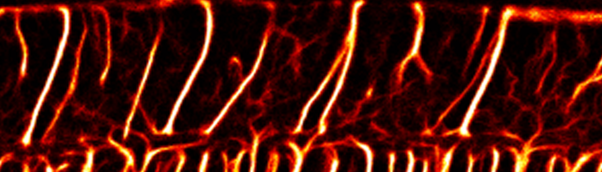 Neurovascular changes during Alzheimer’s disease and aging